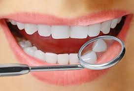 Snowhite Teeth Whitening- farmacia - onde comprar - funciona