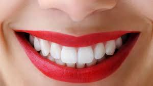 Snowhite Teeth Whitening - clareamento dos dentes - forum - opiniões - creme